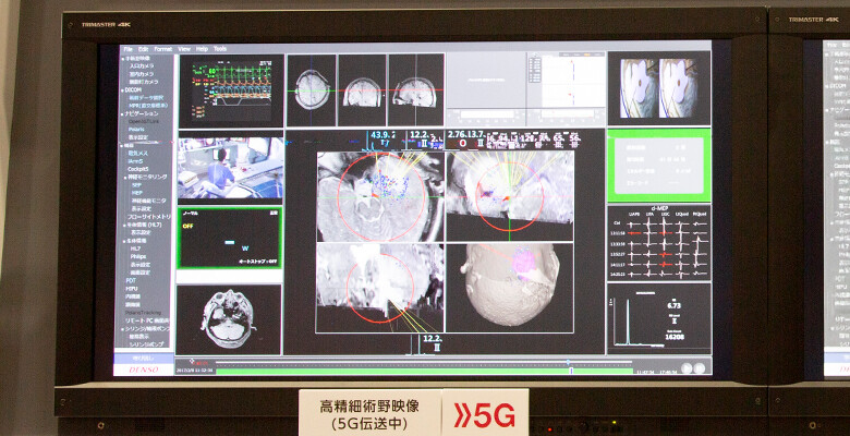 High-speed 5D data transmission has made 3D-MR images--which appear flat with 4G--appear three-dimensional.