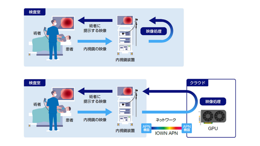世界初、NTTとオリンパスによるクラウド内視鏡システムに関する共同実証実験を開始