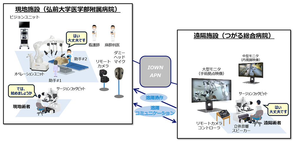 図：APNを活用した遠隔手術支援の構成イメージ